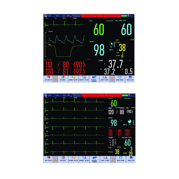 Monitor signos vitales Spacelabs C50 - Imagen 2