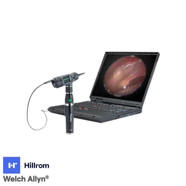 Cabezal Otoscopio Digital Macroview - Imagen 3